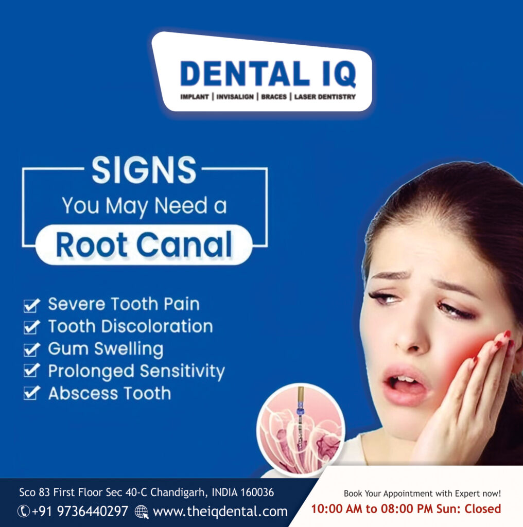 Root Channel Treatment in Chandigarh