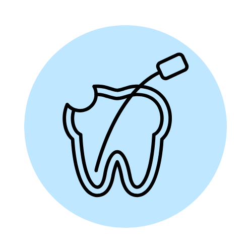 Root Canal Treatment