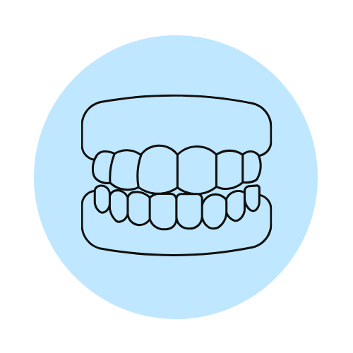 Full-Mouth Rehabilitation
